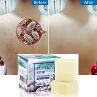 Pimple Removal Sea Salt Soap - Glefidiya